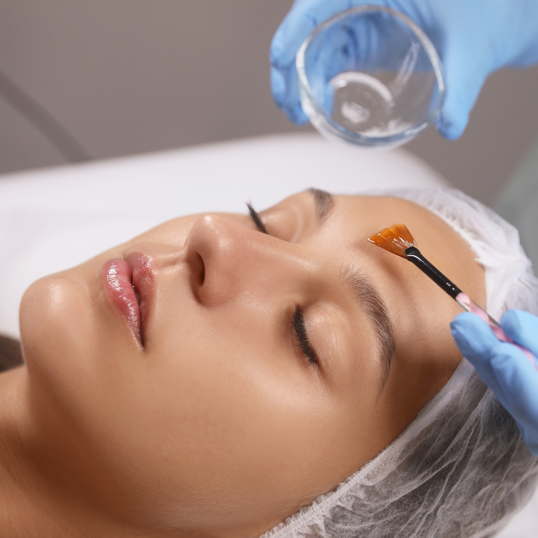 Cosmelan Peel